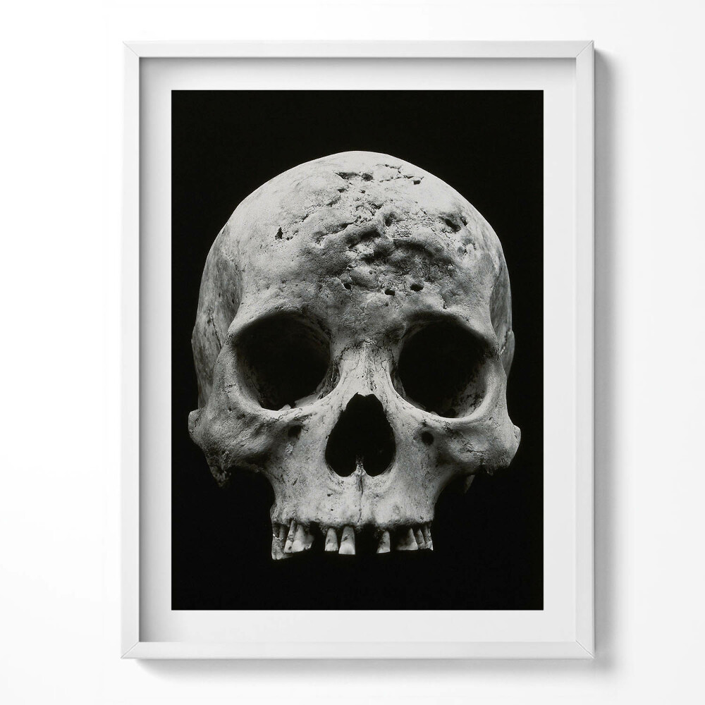 Keretezett kép Emberi koponya csontváz